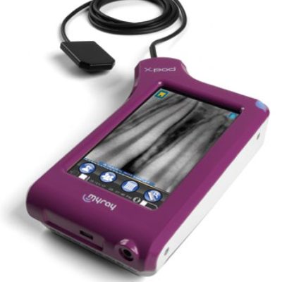 سنسور رادیوگرافی پرتابل MyRay مدل X-Pod